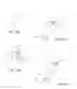 Fig. 44 - Methods and devices to treat nasal airways