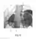 Fig. 07 - Imaging apparatus for imaging a first object within a second object