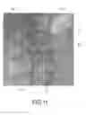 Fig. 08 - Imaging apparatus for imaging a first object within a second object