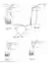 Fig. 08 - Illuminated telescoping cannula