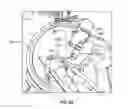 Fig. 08 - Kit and method for reduced radiation procedures
