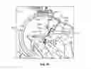 Fig. 10 - Kit and method for reduced radiation procedures