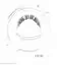 Fig. 04 - Toothbrush and method for proper brushing of teeth and gums in the direction of gum growth optionally with an attached camera