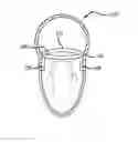 Fig. 01 - Heart valve assembly systems and methods