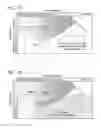 Fig. 02 - Heart valve assembly systems and methods