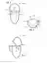 Fig. 04 - Heart valve assembly systems and methods