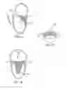 Fig. 06 - Heart valve assembly systems and methods