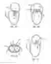 Fig. 10 - Heart valve assembly systems and methods