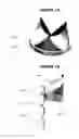 Fig. 02 - Method and apparatus for fine adjustment of a percutaneous valve structure