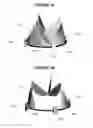 Fig. 04 - Method and apparatus for fine adjustment of a percutaneous valve structure