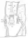 Fig. 01 - Surgical delivery device and method of use