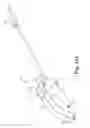 Fig. 16 - Surgical delivery device and method of use