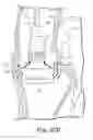 Fig. 29 - Surgical delivery device and method of use