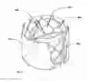 Fig. 03 - Replacement heart valve