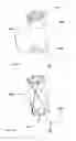Fig. 16 - Replacement heart valve