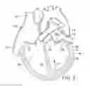Fig. 03 - METHOD AND APPARATUS FOR RESHAPING A VENTRICLE