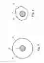 Fig. 04 - Implantable penile prosthetic having a base expandable by liquid inflation