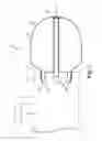 Fig. 07 - Implantable penile prosthetic having a base expandable by liquid inflation