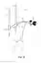 Fig. 12 - Implantable penile prosthetic having a base expandable by liquid inflation