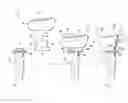 Fig. 01 - Radial head prosthesis with rotate-to-lock interface