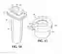 Fig. 06 - Radial head prosthesis with rotate-to-lock interface