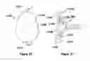 Fig. 17 - Shoulder arthroplasty systems and configurations for components thereof