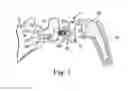 Fig. 02 - Glenoid implant anchor post