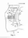 Fig. 04 - Glenoid implant anchor post
