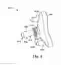 Fig. 10 - Glenoid implant anchor post
