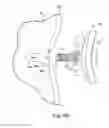 Fig. 12 - Glenoid implant anchor post