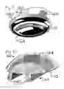 Fig. 04 - Rail-fixing implant