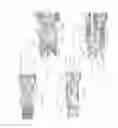 Fig. 08 - Expandable intervertebral implant
