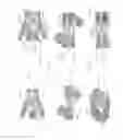 Fig. 09 - Expandable intervertebral implant
