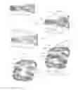 Fig. 12 - Expandable intervertebral implant