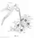 Fig. 12 - Spinal construct and method