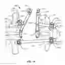 Fig. 13 - Spinal construct and method