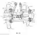 Fig. 15 - Spinal construct and method