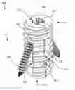 Fig. 01 - Vertebral cage