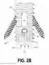 Fig. 06 - Vertebral cage