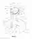 Fig. 04 - Intervertebral implant having extendable bone fixation members