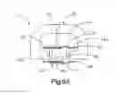 Fig. 28 - Intervertebral implant having extendable bone fixation members