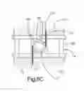 Fig. 33 - Intervertebral implant having extendable bone fixation members