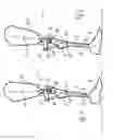 Fig. 02 - Orthopedic knee joint and method for controlling an orthopedic knee joint