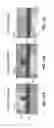 Fig. 14 - ULTRA-LOW FRACTIONAL AREA COVERAGE FLOW DIVERTER FOR TREATING ANEURYSMS AND VASCULAR DISEASES