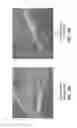 Fig. 15 - ULTRA-LOW FRACTIONAL AREA COVERAGE FLOW DIVERTER FOR TREATING ANEURYSMS AND VASCULAR DISEASES