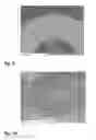 Fig. 07 - BIODEGRADABLE METAL STENT AND METHOD OF MAKING