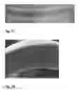 Fig. 11 - BIODEGRADABLE METAL STENT AND METHOD OF MAKING