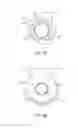 Fig. 09 - Methods for uniform crimping and deployment of a polymer scaffold
