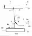 Fig. 02 - Assembly for securing gastrointestinal tissue folds