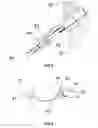 Fig. 08 - Assembly for securing gastrointestinal tissue folds